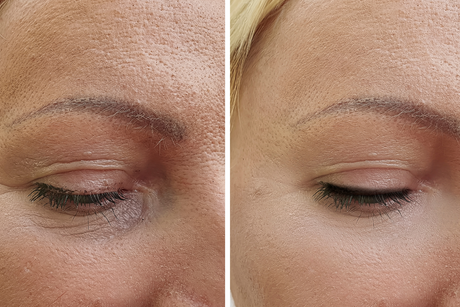 Pourquoi je ne vois pas de résultat avec mon collagène ?