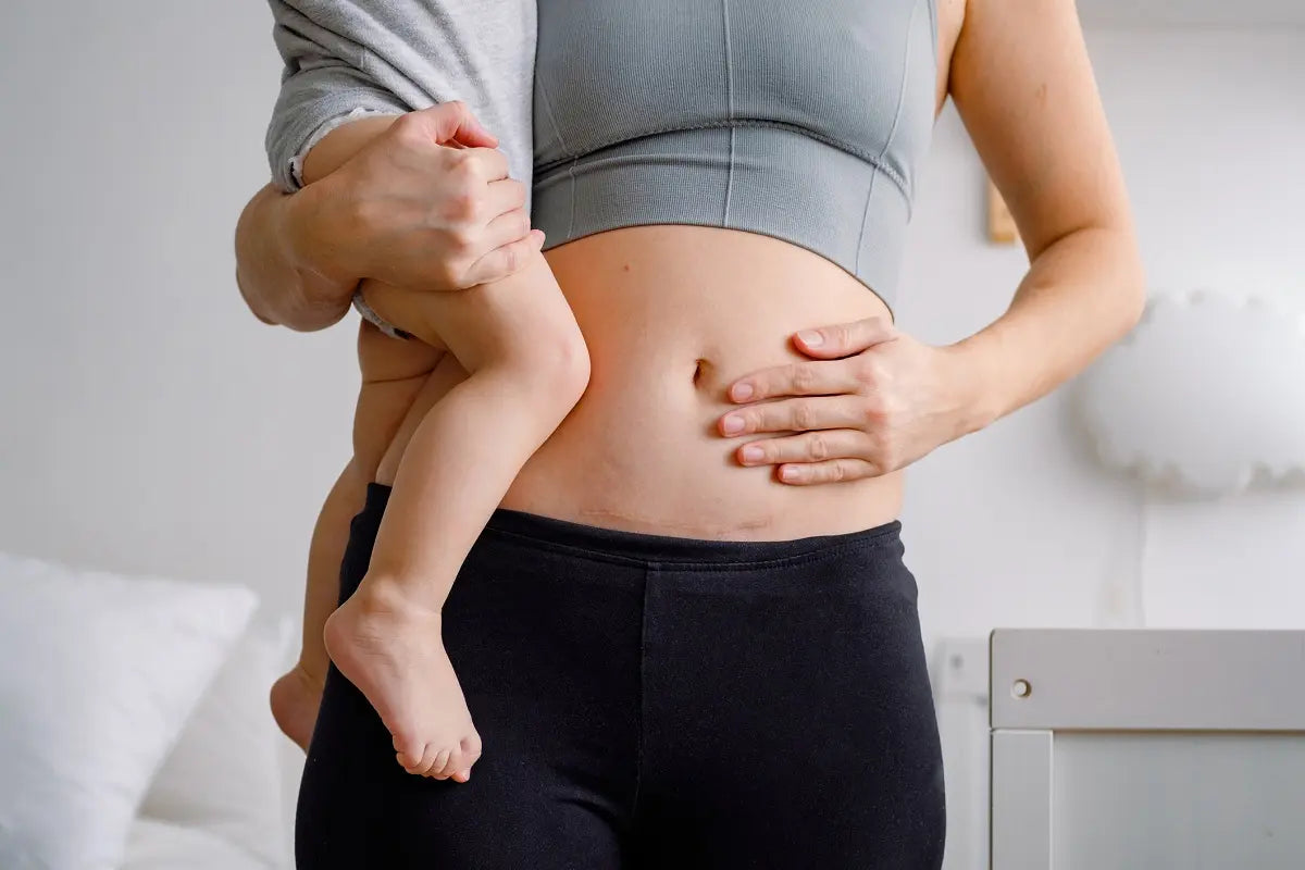 Retrouver un ventre plat après sa grossesse