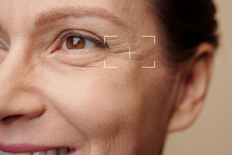 Peau ridée et relâchée